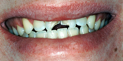 case-10-before-400x200