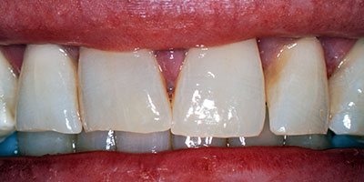 case-12-before-400x200
