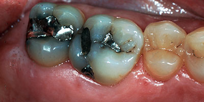case-15-before-400x200
