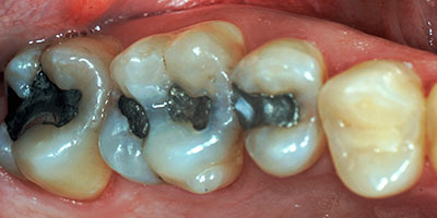 case-16-before-400x200