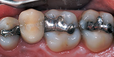 case-17-before-400x200