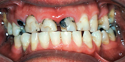case-27-before-400x200