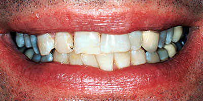 case-29-before-400x200