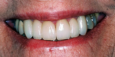 case-3-after-400x200