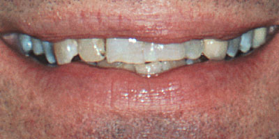 case-30-before-400x200