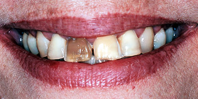 case-31-before-400x200