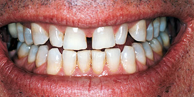 case-6-before-400x200