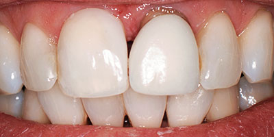 case-7-before-400x200