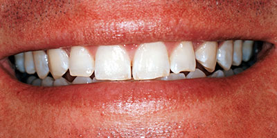 case-8-before-400x200