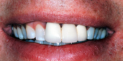 case-9-before-400x200