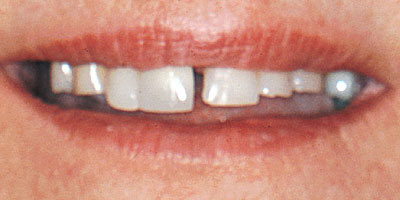 case34--before-400x200